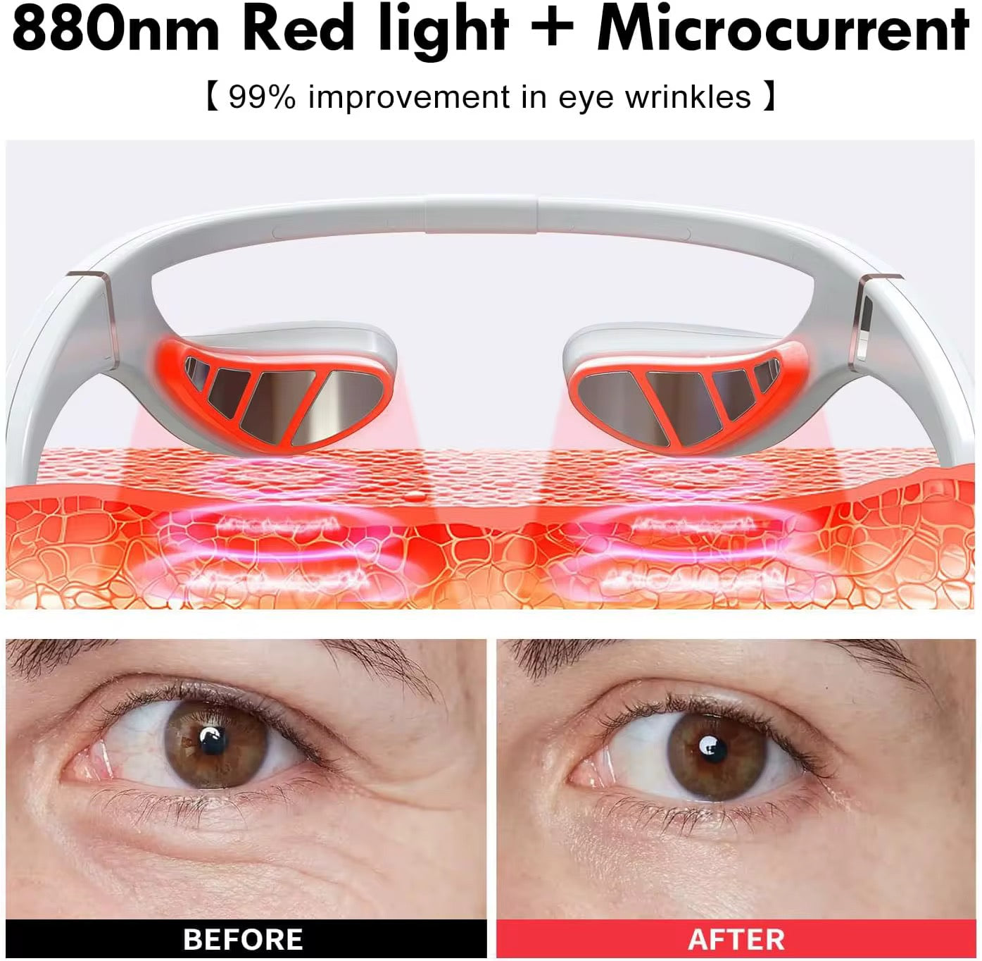 EMS Red LED Light Therapy Eye Massager - Anti-Aging Eye Treatment